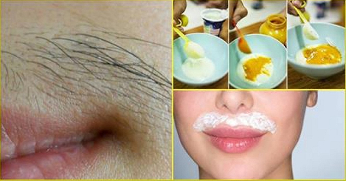 BEAUTY HACKS: How to remove facial hair permanently at home
