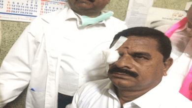 Telangana State Legislative Council chairman K Swamy Goud injured