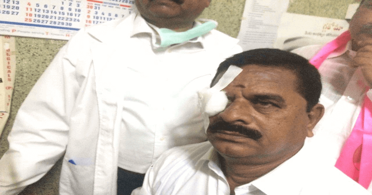 Telangana State Legislative Council chairman K Swamy Goud injured