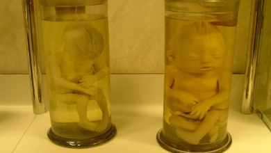 babies preserved