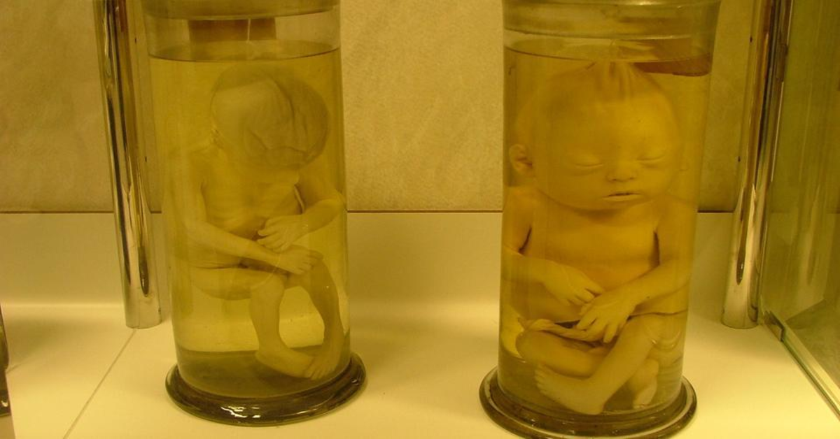 babies preserved