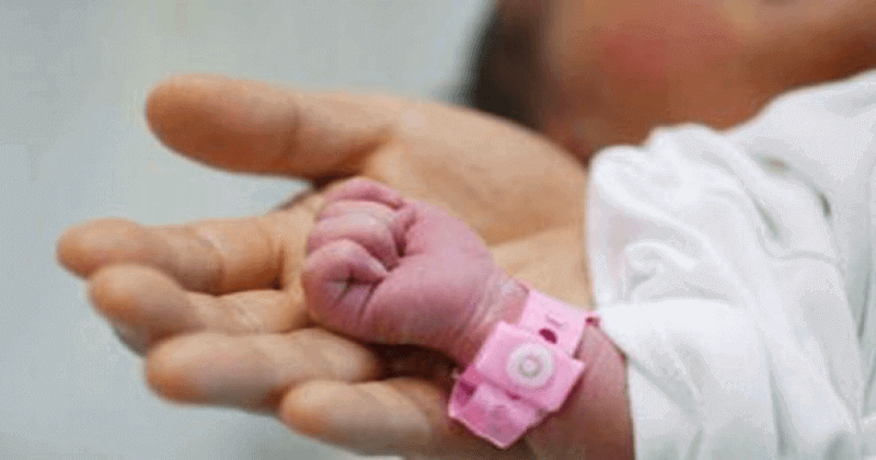 doctors kill newborn baby