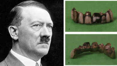 Adolf_teeth