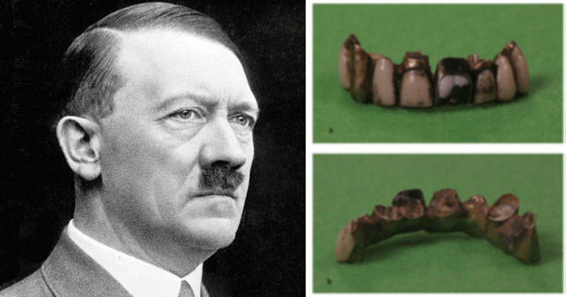 Adolf_teeth