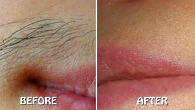 How-to-remove-upper-lip-hair