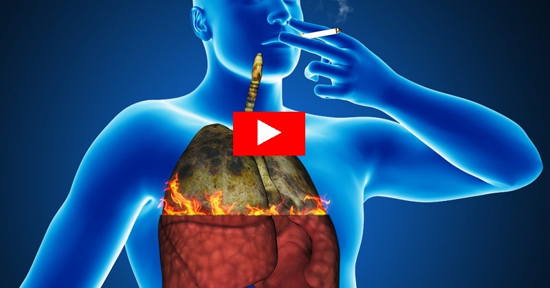 Heavy smoker