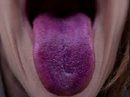 purple tongue