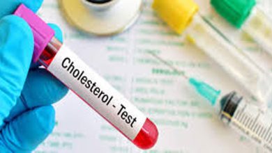 Cholestrol-Natural-Treatments