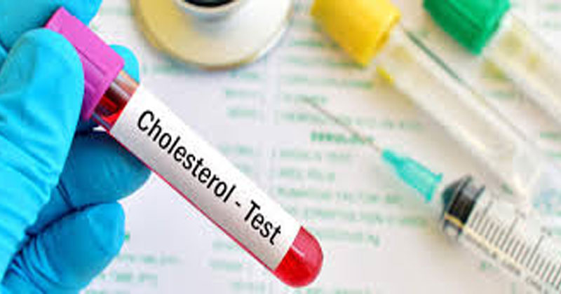 Cholestrol-Natural-Treatments