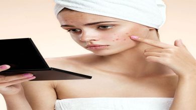 How-to-get-rid-of-Pimples