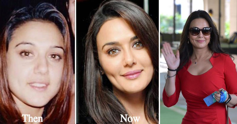 Bollywood celebrities who have undergone plastic surgeries for makeovers