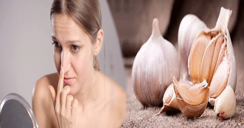 Amazing-Beauty-Benefits-Of-Garlic