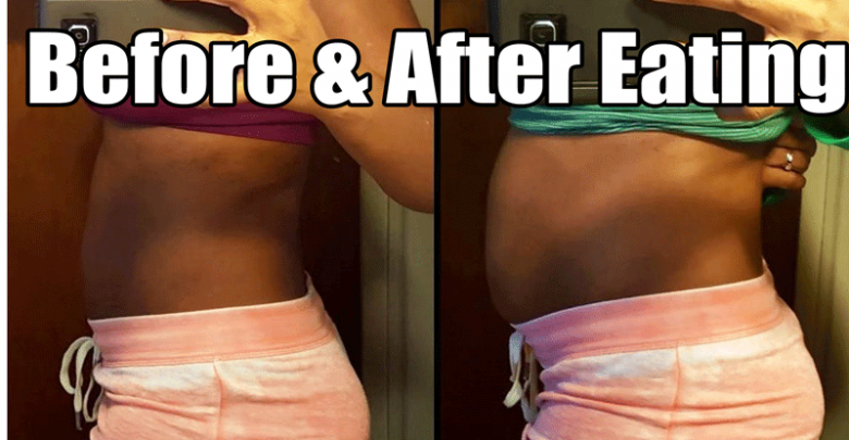 Bloating