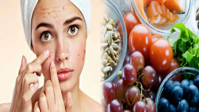 Foods-that-help-to-get-rid-of-Acne