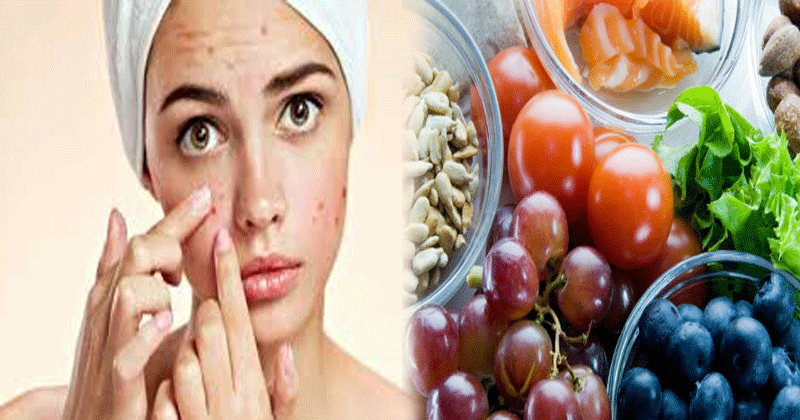 Foods-that-help-to-get-rid-of-Acne