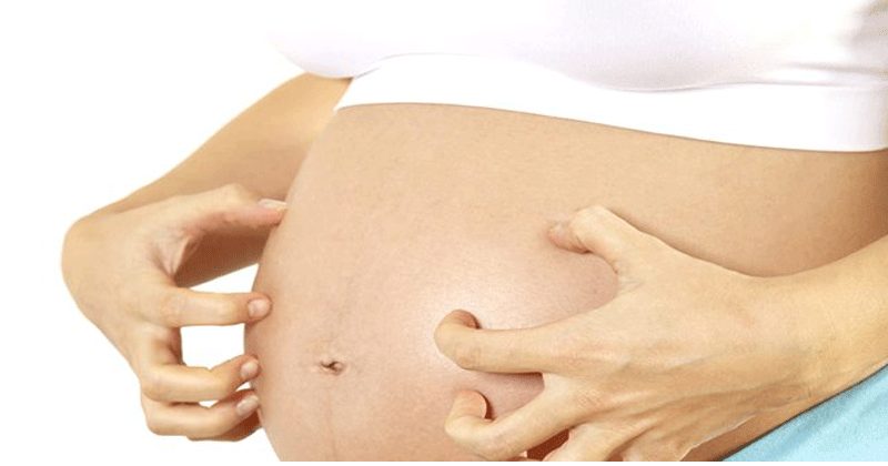 Itching-during-pregnancy