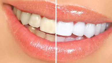 Natural-Way-To-Whiten-Teeth