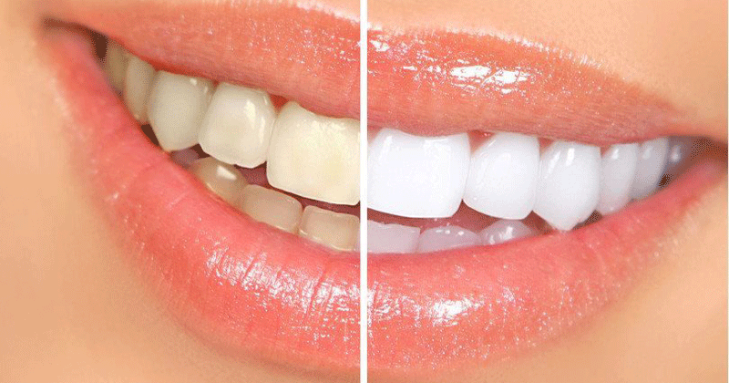 Natural-Way-To-Whiten-Teeth