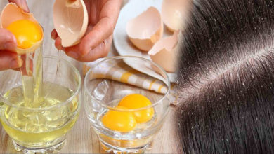 Natural-Home-Remedy-For-Dandruff