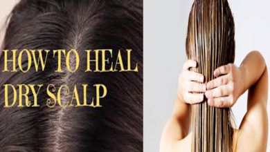 Dry-Scalp