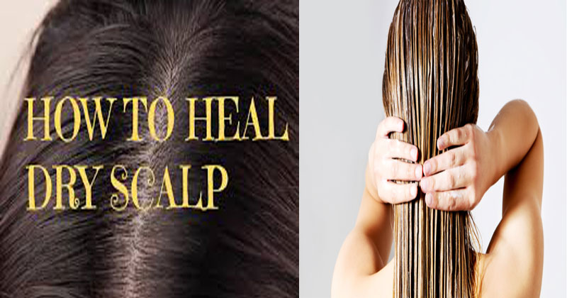 Dry-Scalp