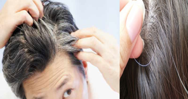 Natural Methods To Get Rid Of White Hair At A Young Age