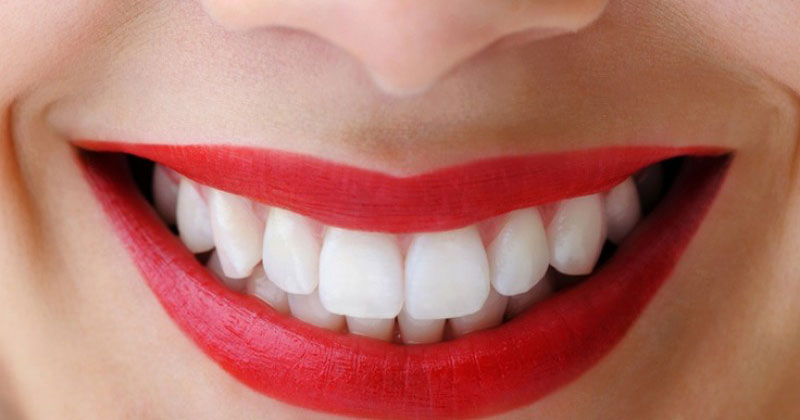 Whiten Teeth